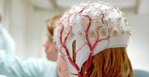 Guidance on Epilepsy Diagnosis