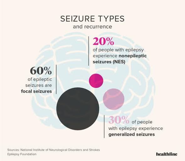 Understanding Different Types of Seizures